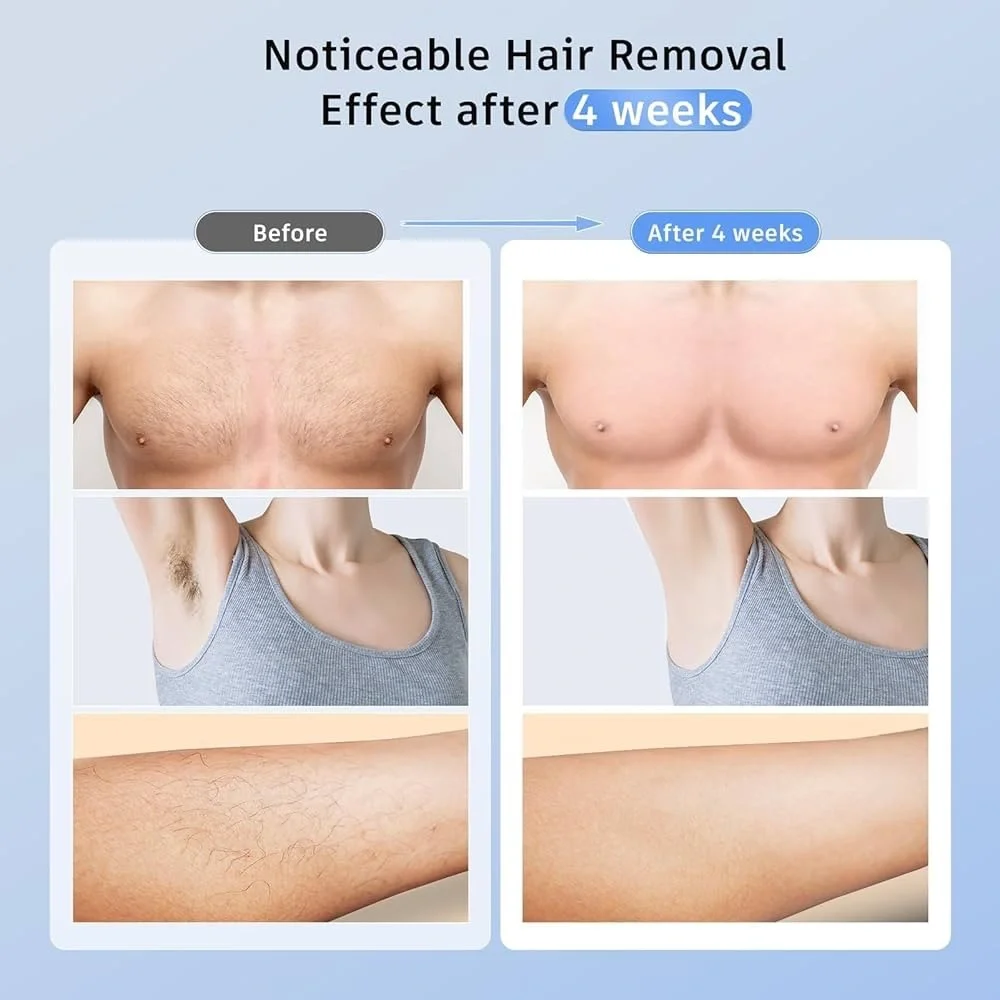 Ice-Cold Laser Hair Remover